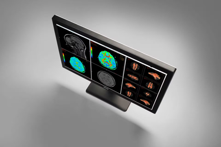 Breast imaging displays