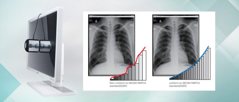 Why Display Calibration Is India’s Most Overlooked Patient Safety Issue