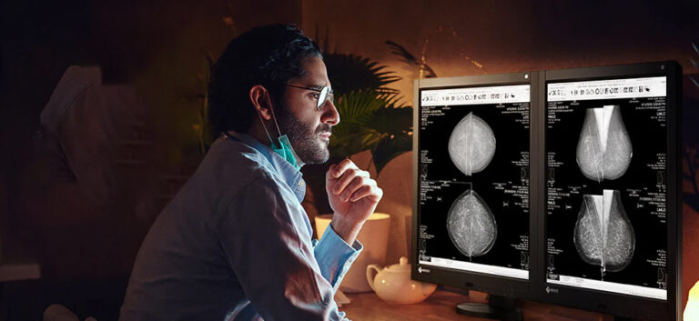 How High-Resolution Mammography Displays Improve Early Breast Cancer Detection