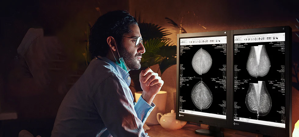 How High-Resolution Mammography Displays Improve Early Breast Cancer Detection